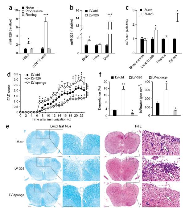 IBCB Scientists Found the Regulatory Mechanism of a MicroRNA in Multiple Sclerosis