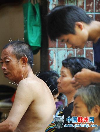 Chinese Acupuncture Seen in Street