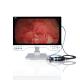 24 Inch 4K Endoscope Camera System with Built in Light Source & Video Recorder Function