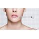 Hyaluronic acid filler for facial dermal to Reduce wrinkle