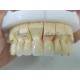 Dental Product Zirconia Layered With Porcelain Easy Maintenance