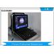 128 Element Diagnostic Color Doppler Ultrasound Scanner With Windows 7 Platform