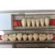 Fake Resin Teeth Composite Resin Denture Teeth Top Hard  3 Layers