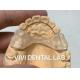 Bonded Wire Teeth Orthodontic Retainer Permanent Professional