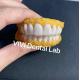 Dental Snap On Smile Veneers High esthetics ISO FDA Certified