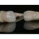 Long-lasting Dental Lab Laminate Veneers Customizable for Various Tooth Preparations