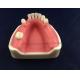 dental implant model with soft gingiva for practice