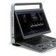 15.6'' LCD Sonoscape E2 Ultrasound Machine With 2 Year Warranty