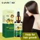 30ml / Bottle Hair Growth Products Ginger Hair Regrowth Oil Anti Hair Loss