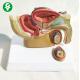 Male Reproductive System Anatomy Model Diseased Reproductive Prostate Visceral