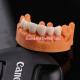 Comfort and Function with Digital CAD CAM Dental Lab Translucent Layered Zirconia Bridge
