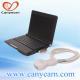a medical cardiac ultrasound equipment with high definition technology
