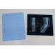 Blue PET Inkjet Medical X Ray Film For Epson Printer
