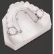 Dental Stable Quad Helix Palate Expander For Improving Molar Rotation