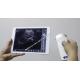 Ipad connecting Wireless Convex Probe Ultrasound Scanner with built-in battery