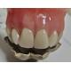 Esthetics Full Denture Cold Cured Acrylic Partial Denture