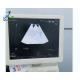 Doppler Ultrasound Machine Repair RXBF HI VISION Avius Image Bright Channel Interference Radiography Scanner