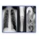 Holographic Medical Imaging Film , Thermal Printers PET X Ray Film