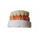 Temporary PFM Dental Crown Smooth Surface High Quality Assurance