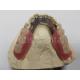 OEM Flexible Removable Partial Denture  Easy To Clean / Maintain