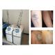 CE Approved ND YAG Laser Tattoo Removal Machine For Laser Pigmentation Removal