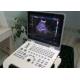 Color Doppler Ultrasound Machine Ultrasound Medical Equipment With 5 Kinds Languages