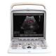 Portable 3.5MHz 7.5MHz 6.0 MHz Ultrasound Scanner Machine For Gynecology