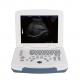 BW Laptop Ultrasound Machine Full Digital Ultrasound Scanner GH580