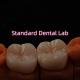 Full Contour Bruxier Monolithic Zirconia Crown Bridge Dental Lab