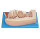 Human Teeth Model , 21 Positions are Displayed of Mandibular Permanent Teeth about  Child