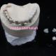 FDA Noritake Porcelain Malo Bridge Dental Restoration