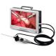 ENT Medical All In One Endoscope Camera System 22