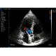 128 Element Cardiac Ultrasound Scanner Color Doppler Android 3.6MHz