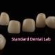 Dental Strong Layered Zirconia Crowns Full Upper Arch Restoration