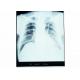 Dry X Ray Medical Diagnostic Imaging Radiology For AGFA / FUJI 2000