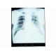 Medical Dry Imaging Film X-ray For AGFA 5300 / 5302 / 5500 KND-A