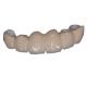 Smooth Surface Porcelain Dental Crown Restore Chewing Power Good Stability