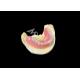 Full acrylic Dentures Custom Removable Denture  Easy To Clean and Long-lasting