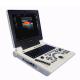 Best Cheap Price Medical Ultrasound Diagnostic System Laptop Portable Color Doppler Ultrasound Machine for Hospital