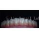 Smooth Surface Cosmetic Tooth Coverings Natural Porcelain Veneers Customizable