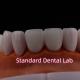 Tranlucent Emax Zirconia Laminate Veneers Porcelain Dental Veneers Chemically Verystable