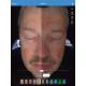 Facial 3d Skin Analyzer Scanner Visia 32gb Storage For Doctor Skin Clinic