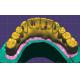 Professional Dental Crown Design Implants And Bridges 3 Shape Exocad
