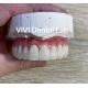 Implant Metal Ceramic Dental Bridges Screwed Retained With Stump