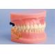 Model of Periodontal Disease Human Teeth Model for Medical Colleges and Clinic Training