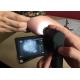Video Skin Microscope Portable Dermatoscope With 3 Inch TFT Color Rotatable Display