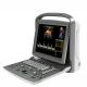 12 Inch LED Chison Portable Ultrasound Machine ECO6 With Long Battery Life