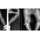 20 x 25cm Laser X Ray Medical Imaging , DT1B / DT2B Agfa X Ray Film