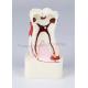 4 times dental disease comprehensive disease model dental caries dental calculus pulp stone occlusal wear pathological