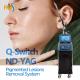 Skin Rejuvenation ND YAG Laser Machine  Q Switched 1064nm Carbon Laser Peel Machine